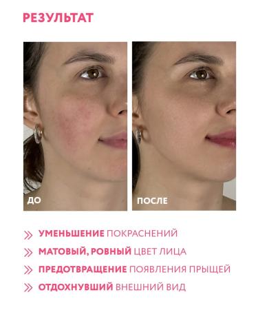 ARAVIA Professional Soothing Biomimetic Care Sos Tonik for the Face 100 ml - Buy Online on GoSupps.com