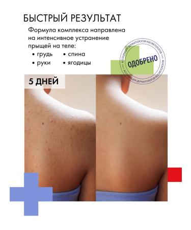 BeautyCevtika Acne and acne lotion - a set of acnevicide body - Buy Online on GoSupps.com