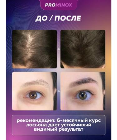 PROMINOX Hair and eyebrow growth serum 60 ml 2% - Buy Online on GoSupps.com