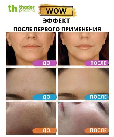 Thader Pharma Hyaluronic acid of the serum for the face - Buy Online on GoSupps.com