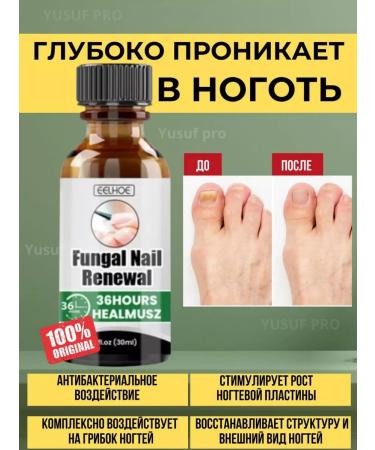 Sadoerr Remedy for toenail fungus - Buy Online on GoSupps.com