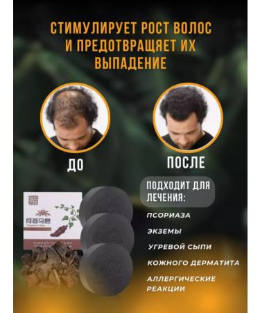 lineSel Korean black soap from falling out and for hair growth 3 pcs - Buy Online on GoSupps.com