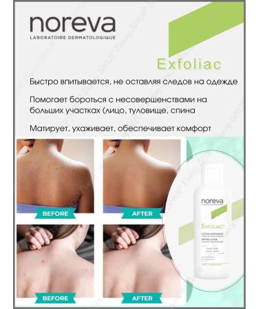 noreva Exfoliac Lotion cleansing with acids against acne - Buy Online on GoSupps.com