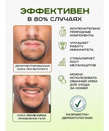 Greenativa Gel from the vitiligo of white skin spots - Buy Online on GoSupps.com
