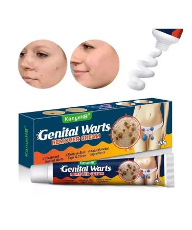 DS Health Cream for removing moles and warts 20 g