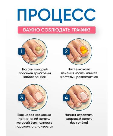 Remedy for nail fungus Therapeutic effective - Buy Online on GoSupps.com