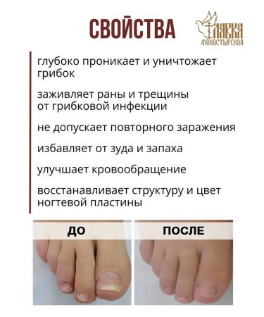 Monastery shop Ointment against the fungus and itching of the body of the body 30ml - Buy Online on GoSupps.com