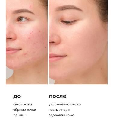 Likato professional Complex to moisturize the skin of the face - Buy Online on GoSupps.com