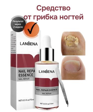 Yusha Essence - a remedy for nail fungus