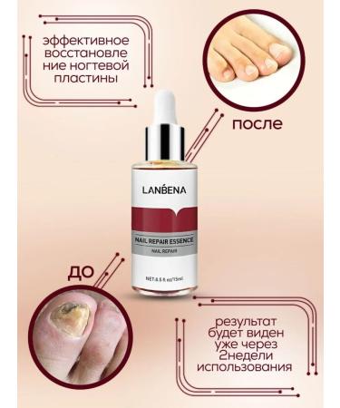 Yusha Essence - a remedy for nail fungus - Buy Online on GoSupps.com