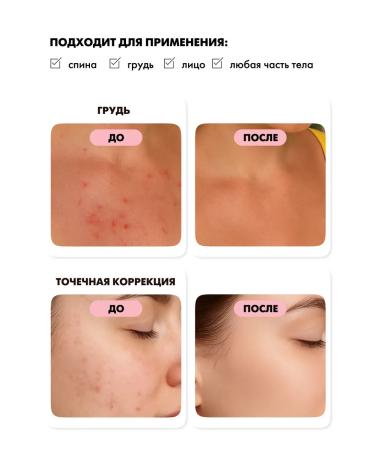 EMi Facial serum from acne with niacinamide and zinc 30 ml - Buy Online on GoSupps.com