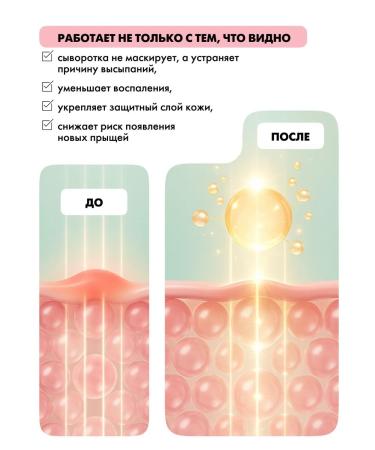 EMi Facial serum from acne with niacinamide and zinc 30 ml - Buy Online on GoSupps.com