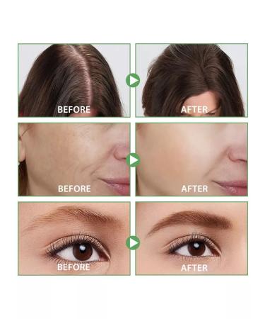 Nifeishi Hair monastery strengthening oil - Buy Online on GoSupps.com