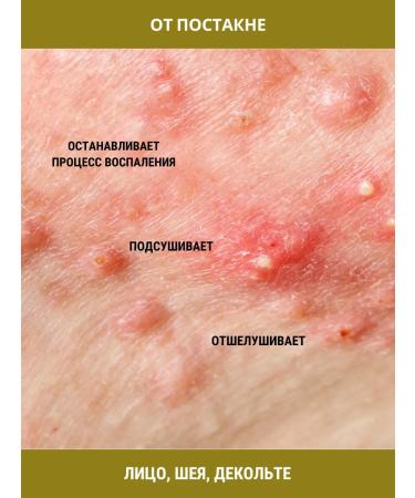 Tough Guy Badyaga natural mask mask 1pc 5g - Buy Online on GoSupps.com