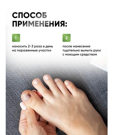 Althea Remedy for nail fungus and legs Mycoplax mycoplas - Buy Online on GoSupps.com