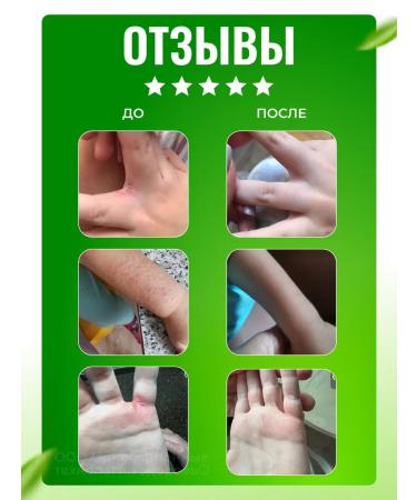 Innovative Health Technologies LLC Aminosorb sorbent for weight loss - Buy Online on GoSupps.com