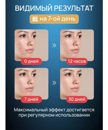 KANGFEI Facial serum from acne with salicylic acid - Buy Online on GoSupps.com