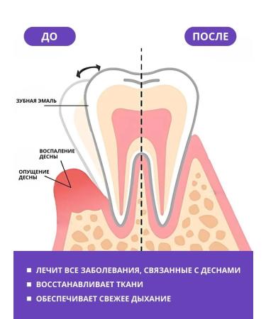 eelhoe Toothpaste whitening 60 ml - Buy Online on GoSupps.com