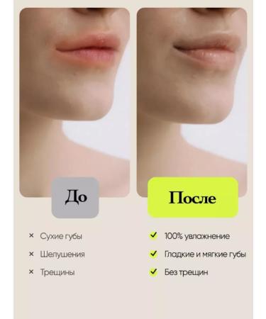 WELCOS Lip balm moisturizing with an extract of peach Korea - Buy Online on GoSupps.com