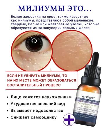 ZaKrasoty Serum from milias on the skin around the eyes - Buy Online on GoSupps.com