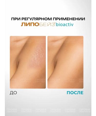 LIPOBASE Bioactive Emulsion for Facial and Body 250 ml - Buy Online on GoSupps.com