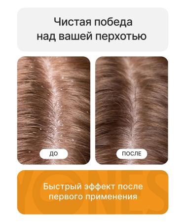 Yones  - Buy Online on GoSupps.com