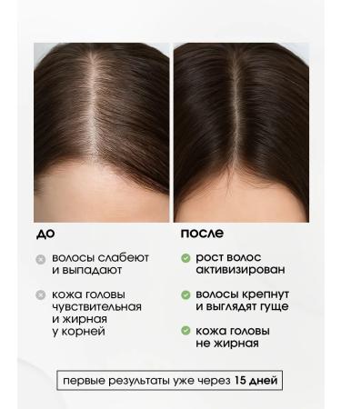 Esthetie Loton-serum for hair growth from falling out - Buy Online on GoSupps.com