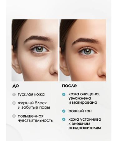 Esthetie Face mask cleansing of black dots acne and inflammation - Buy Online on GoSupps.com