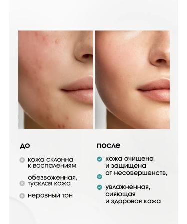 Esthetie Facial serum from acne and acne with niacinamide and zinc - Buy Online on GoSupps.com