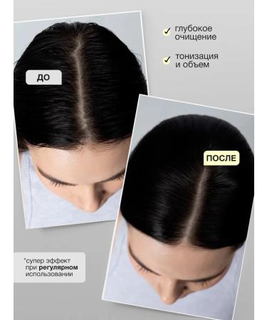 Tashe Piling for scalp against hair loss - Buy Online on GoSupps.com