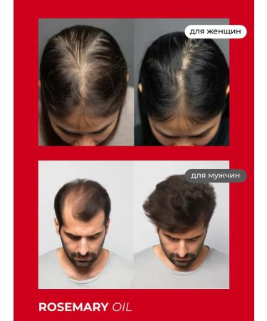 Reformawm Rosemary oil for hair growth - Buy Online on GoSupps.com