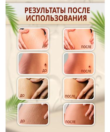 Luxurelle Stretching cream for teenagers - Buy Online on GoSupps.com