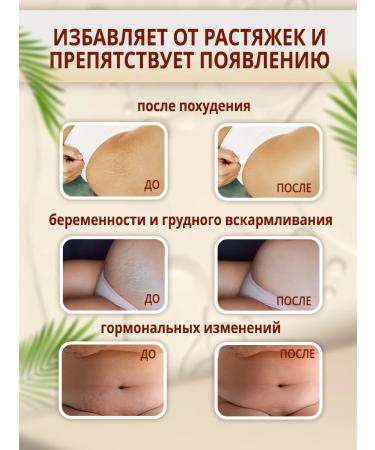 Luxurelle Stretching cream for teenagers - Buy Online on GoSupps.com