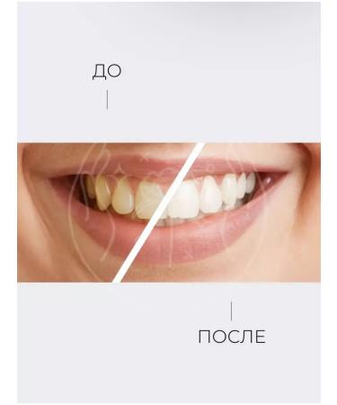 Zicosmetics Whitening toothpaste Median 120 - Buy Online on GoSupps.com