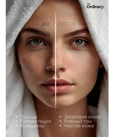 The ordinary Serum with niacinamide 10% + zinc 1% - Buy Online on GoSupps.com