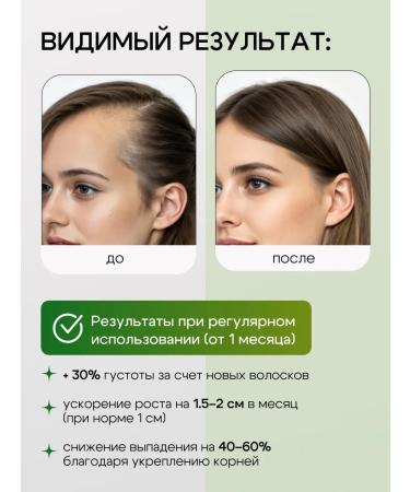 OG Beaute Magnesium oil for hair growth with rosemary and vitamin B3 - Buy Online on GoSupps.com