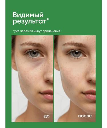 NURA LABORATORIES Liquid eyes for eyes from bags and edema - Buy Online on GoSupps.com