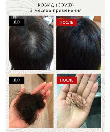 FOLLISYSTEM Serum against loss and for hair growth fs1 30 ml - Buy Online on GoSupps.com