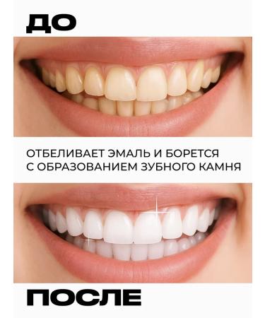 LION Toothpaste 1pc - Buy Online on GoSupps.com