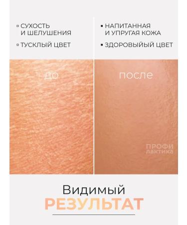 Skinactive Body emulsion with hyaluronic acid 250 ml - Buy Online on GoSupps.com