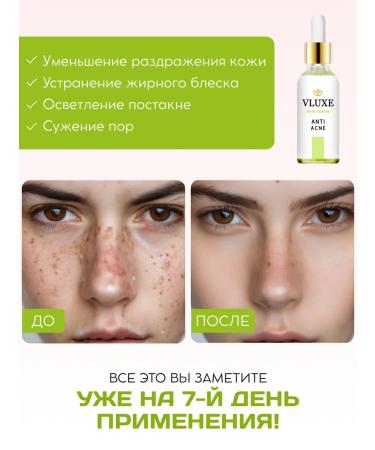 VLUXE Acne serum and acne 2x30 ml - Buy Online on GoSupps.com