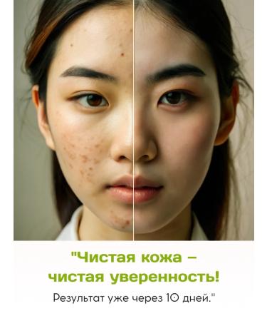 VLUXE Acne serum and acne 2x30 ml - Buy Online on GoSupps.com