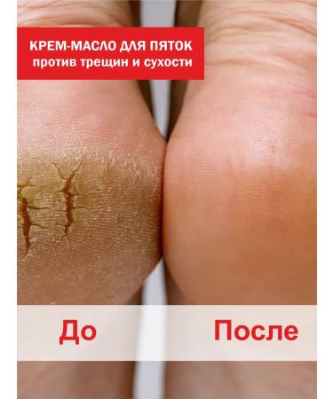 Fly agaric against Cream oil for heels from cracks and dryness 2 pcs - Buy Online on GoSupps.com