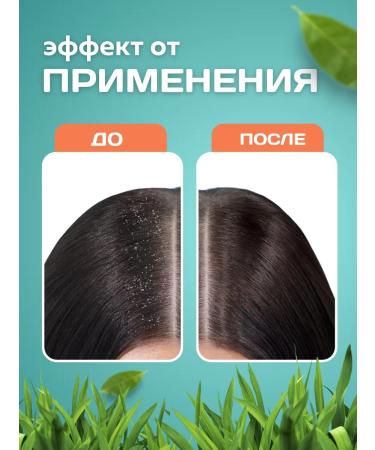 Sulsen Set of dandruff shampoo + paste - Buy Online on GoSupps.com