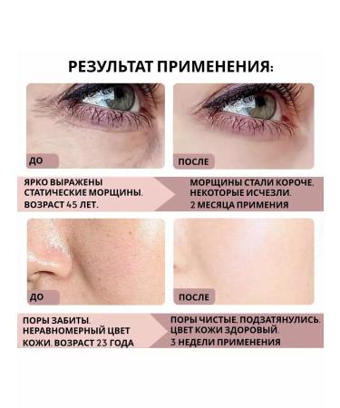 Eccos Face cream against wrinkles with retinol 50 ml - Buy Online on GoSupps.com