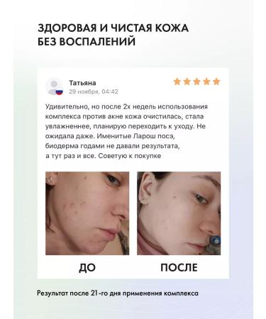 BeautyCevtika Acne gel and black dots - a set of acnevicide forte - Buy Online on GoSupps.com