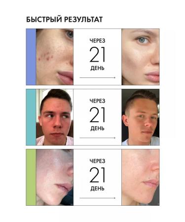 BeautyCevtika Acne gel and black dots - a set of acnevicide forte - Buy Online on GoSupps.com