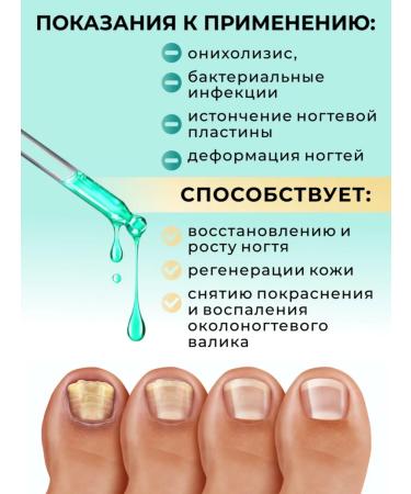 AYA Remedy for nail fungus serum stop onycholisis - Buy Online on GoSupps.com