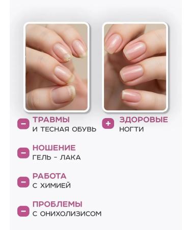 AYA Remedy for nail fungus balm of stop onycholisis - Buy Online on GoSupps.com