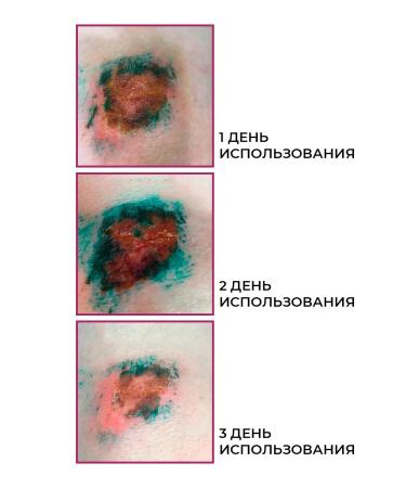 ROSILAK Cream for legs moisturizer cream mask with cracks on heels - Buy Online on GoSupps.com